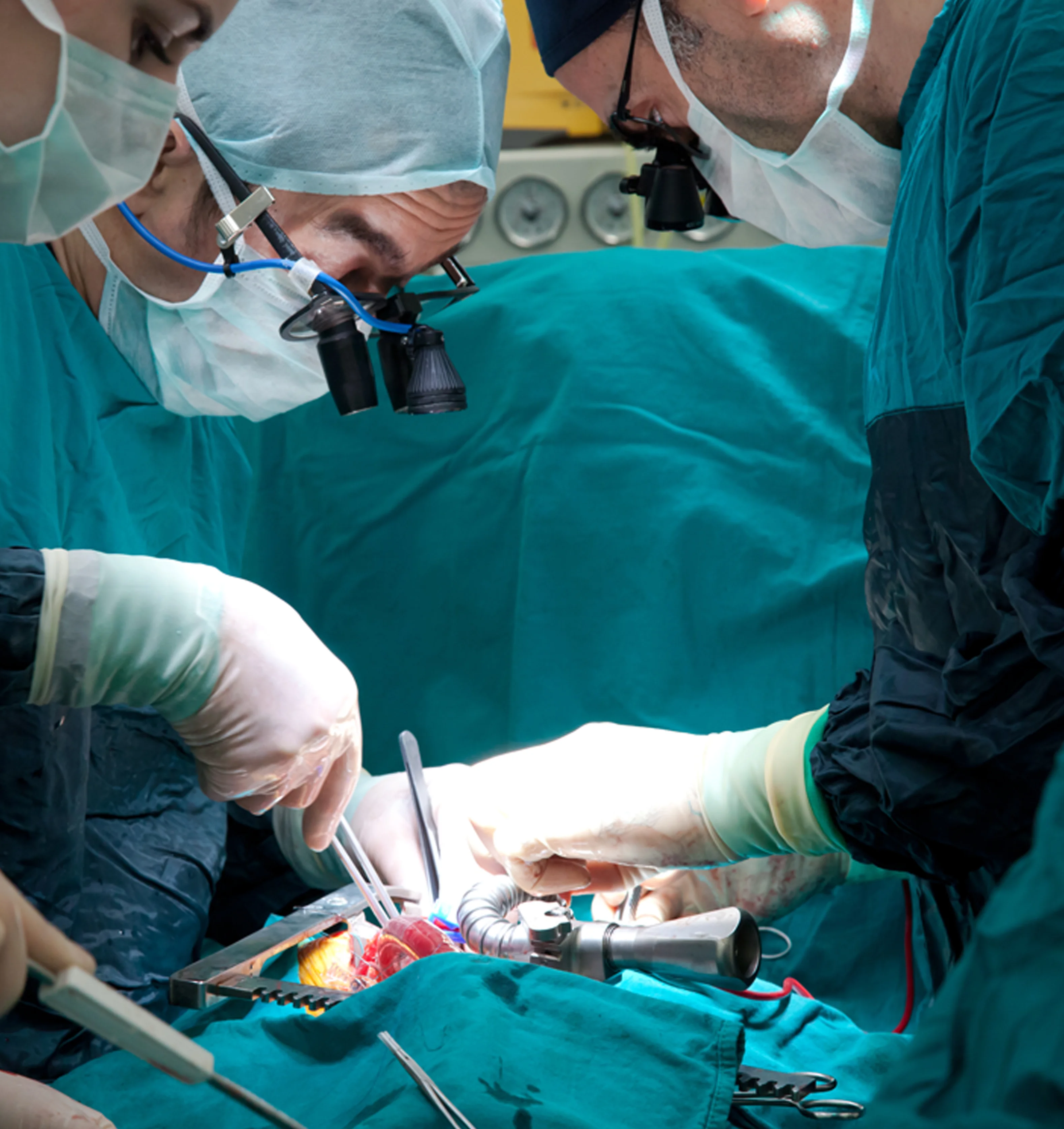 Cardiac Surgery